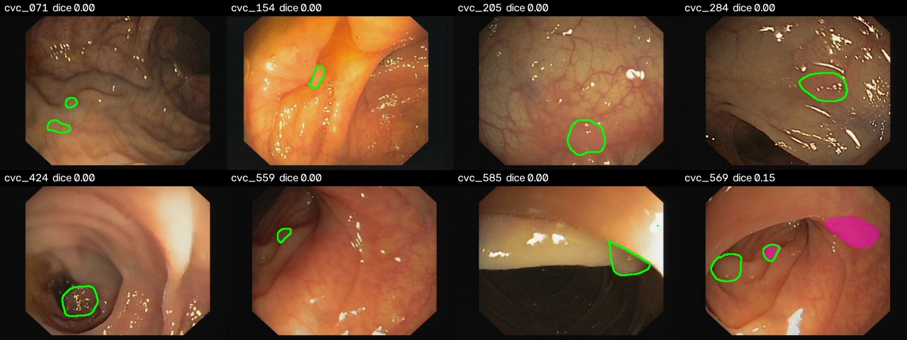 Small-polyp failures